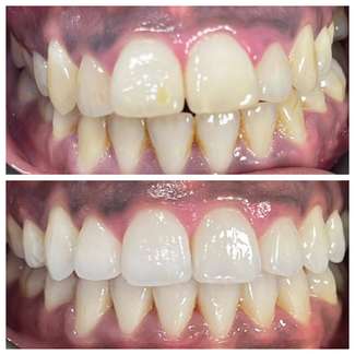 Patient smile transformation 2